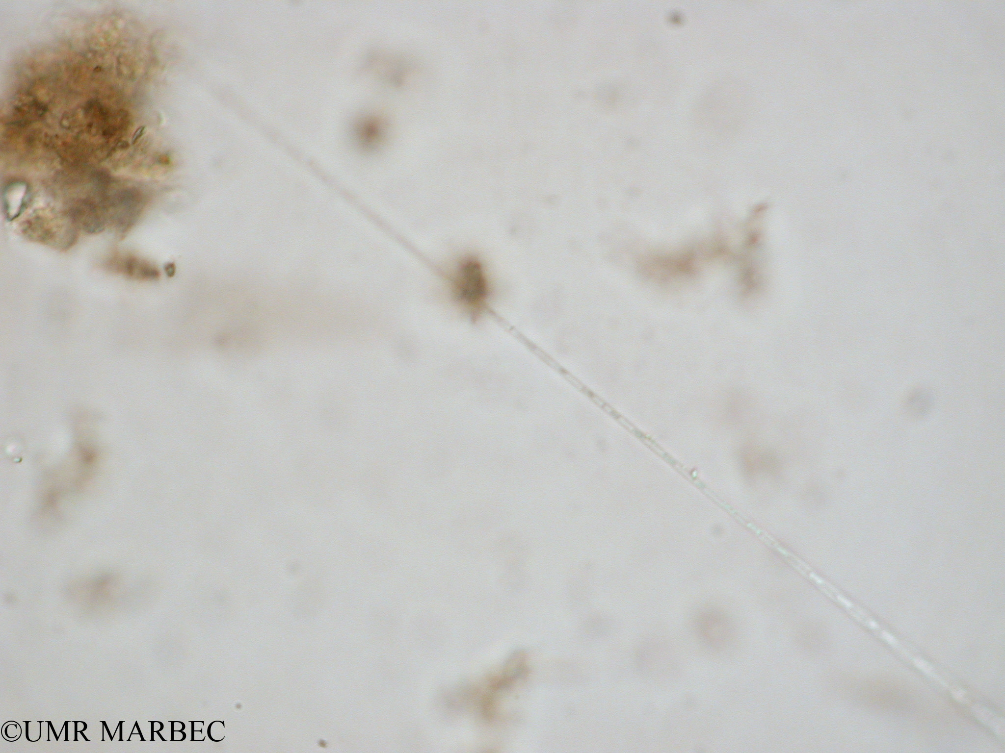 phyto/Tulear Lagoon/all/ICAR2 Avril 2008/Leptocylindrus minimus (Inconnu 12 MACROx1.5x40)(copy).jpg